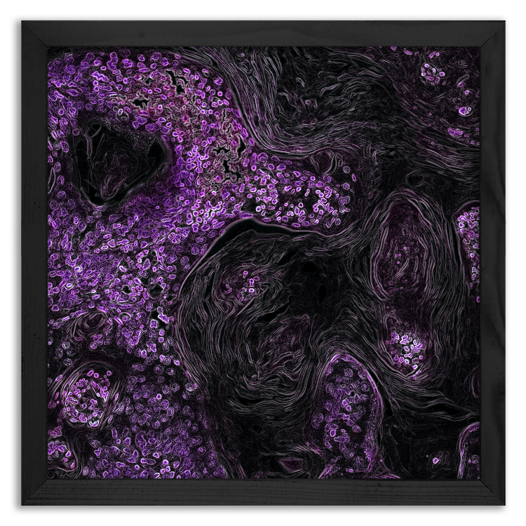 Neoplastic changes in the lungs of mice