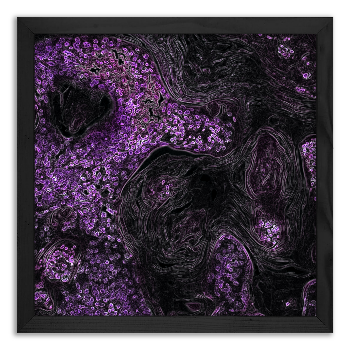 Neoplastic changes in the lungs of mice