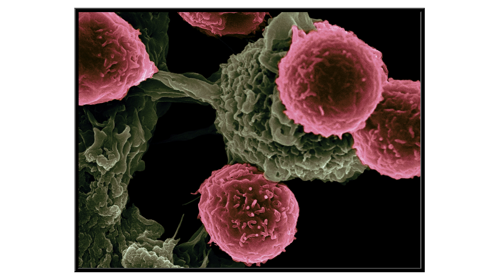 Komórka dendrytyczna „legitymuje” się przed Limfocytem T.