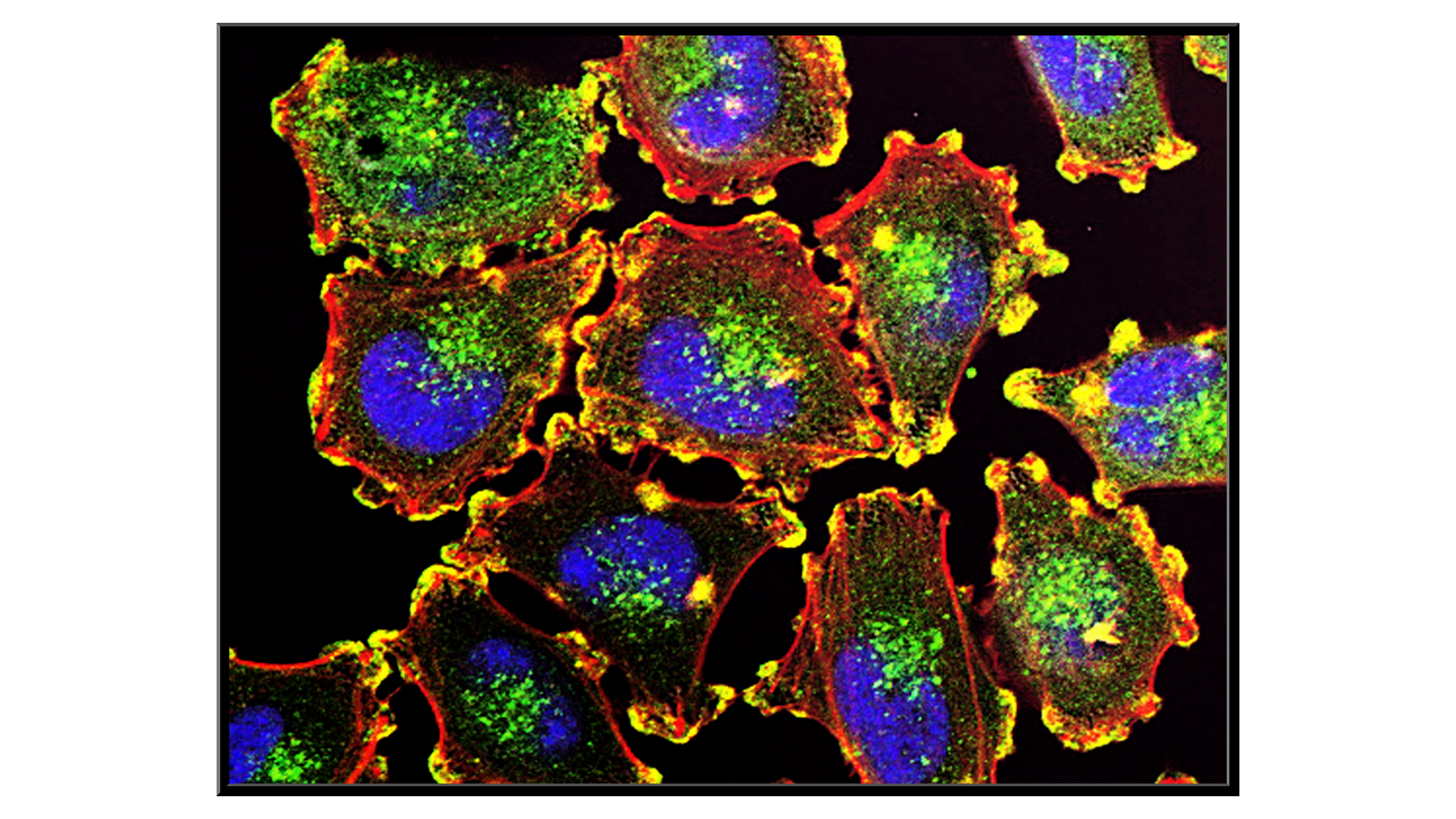 Mobilność komórek czerniaka  
