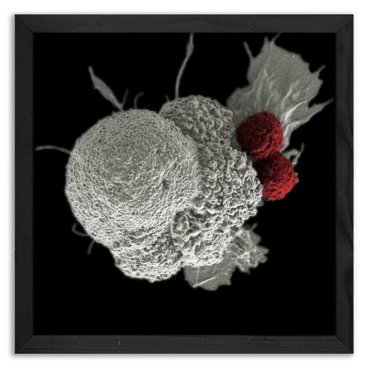 Attack of the immune system on unwanted cell