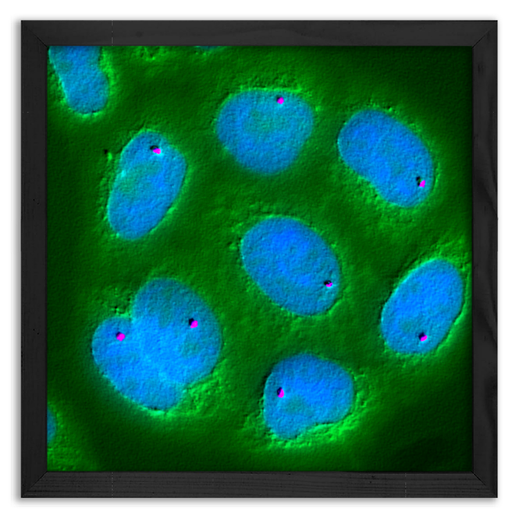 The PEM gene within DNA