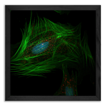 Fibroblastic cell
