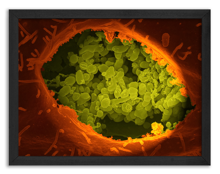 Bacteria Coxiella Burnetii