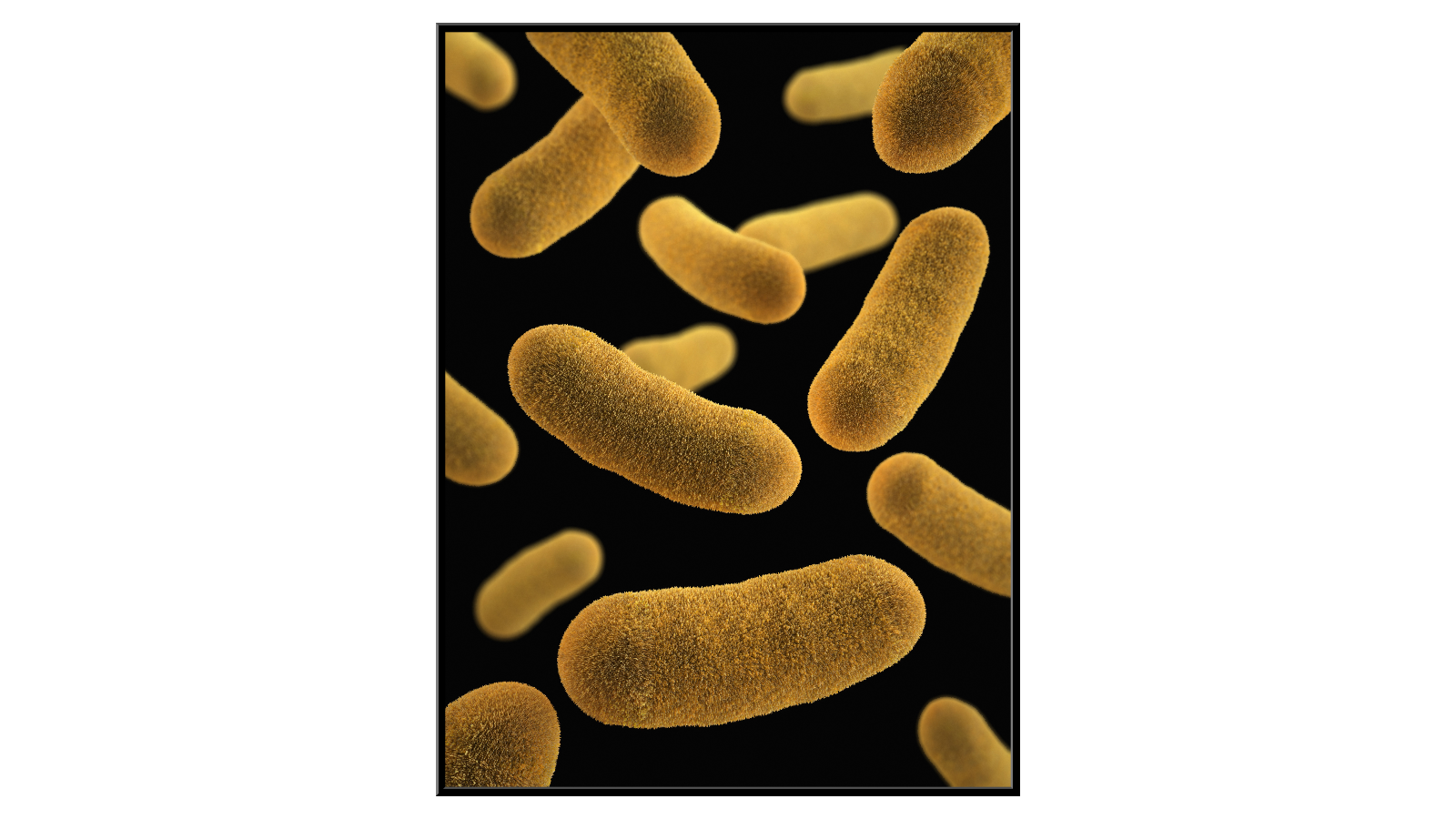 Bakteria Yersinia Enterocolitica