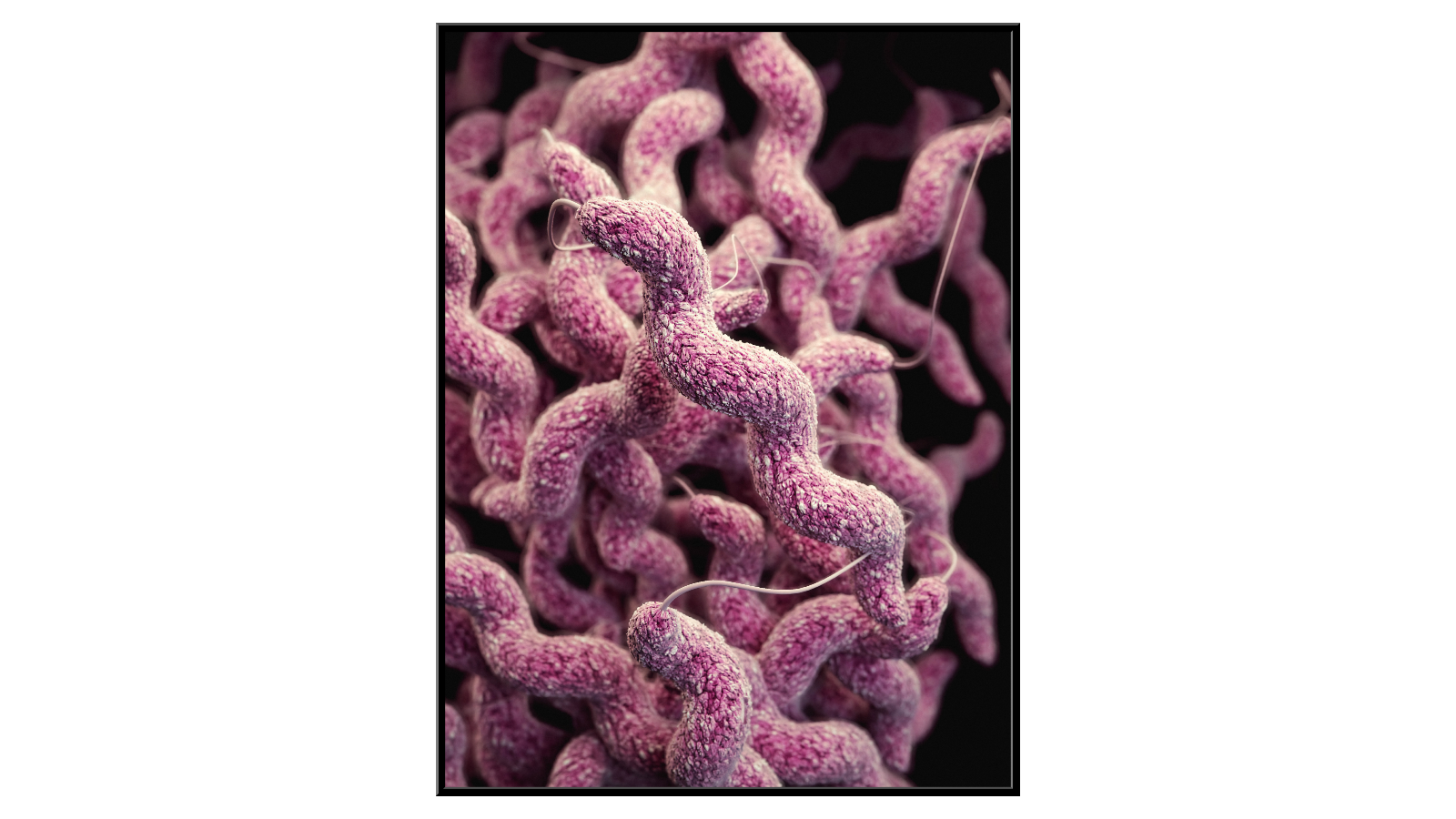 Bakterie Campylobacter