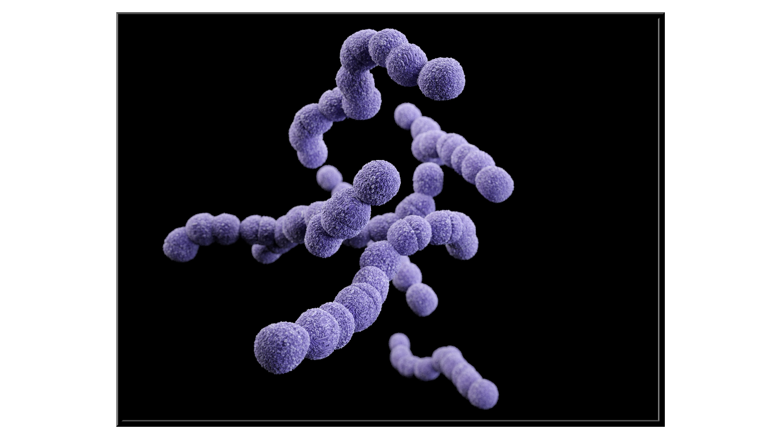 Streptococcus Agalactiae bacteria