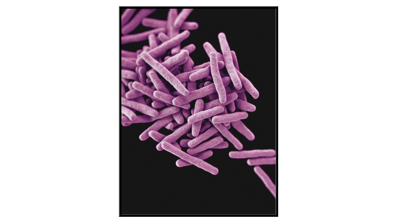 Mycobacterium Tuberculosis bacteria
