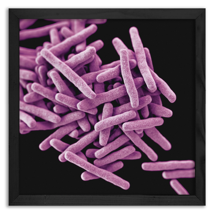 Mycobacterium Tuberculosis bacteria