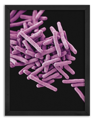 Bakteria Mycobacterium Tuberculosis