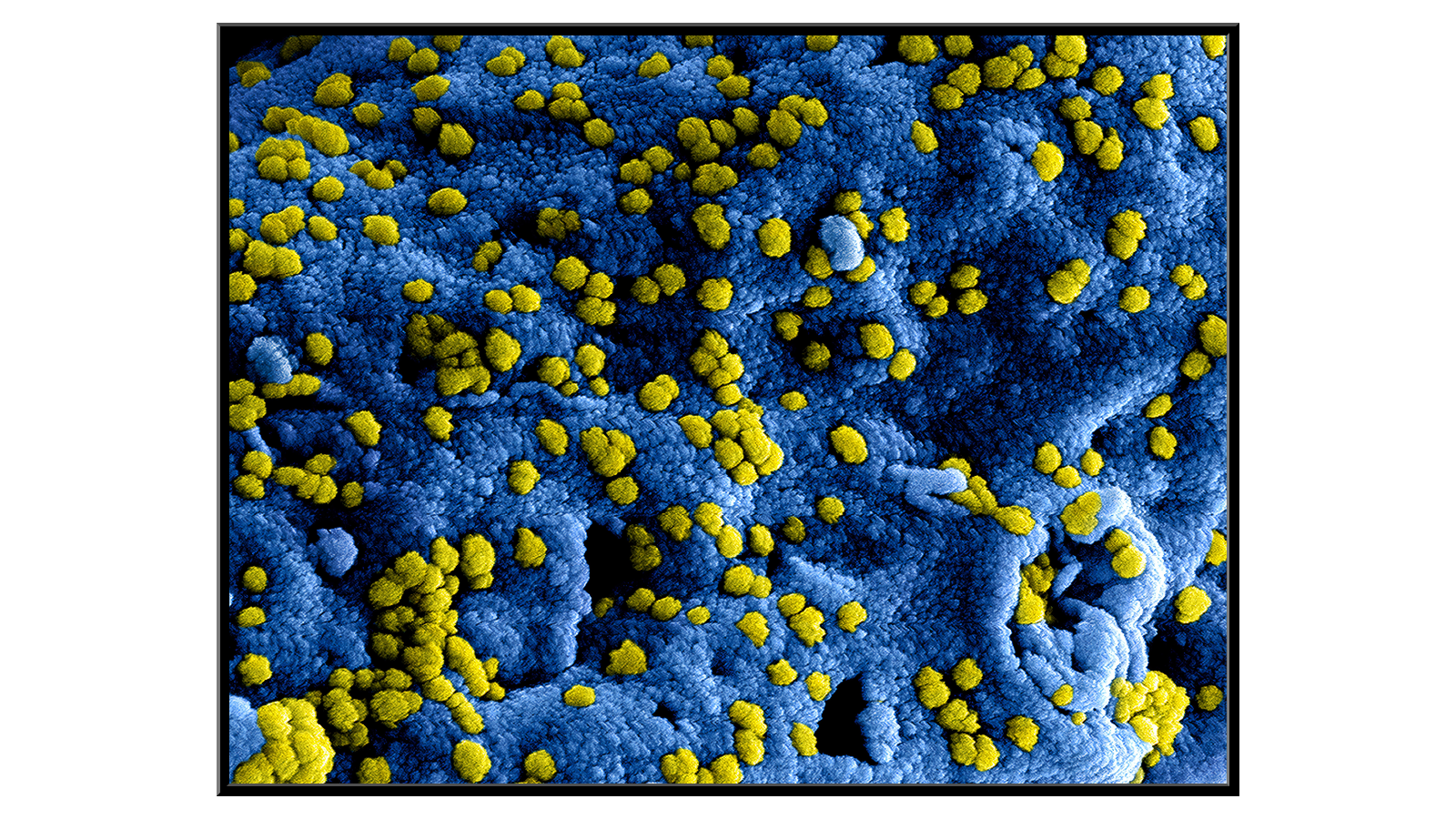 Wirus SARS-CoV-2 infekuje komórkę Vero