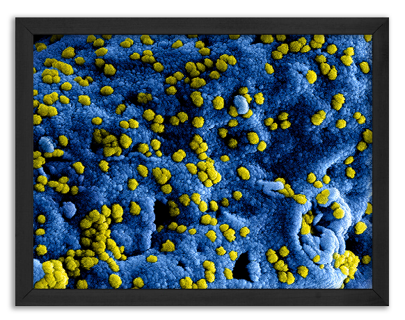 Wirus Covid infekuje komórkę Vero