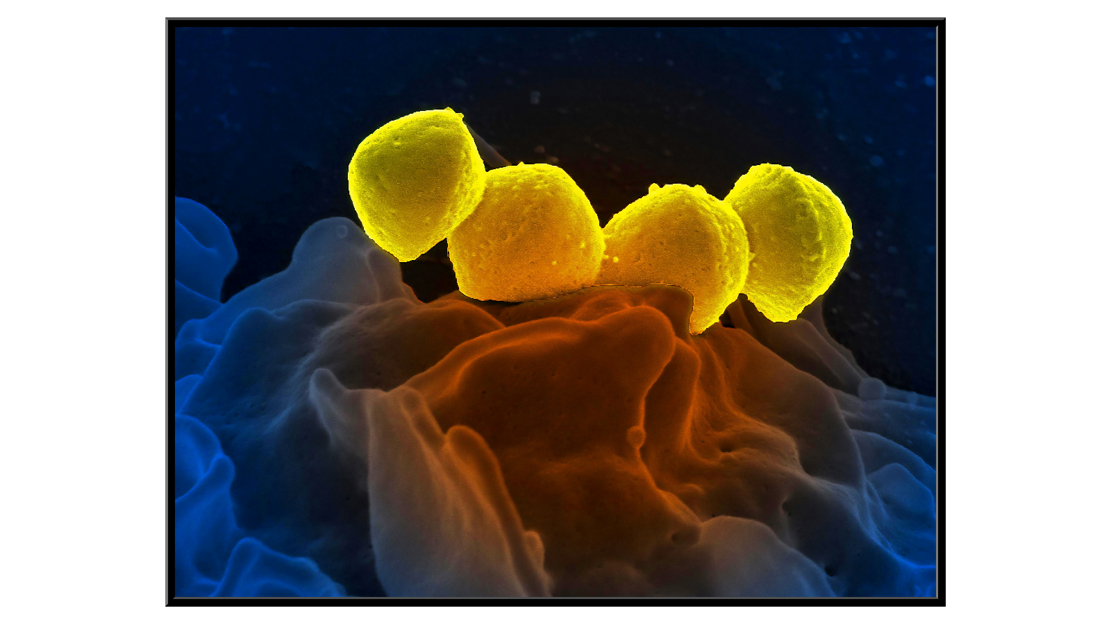 Białe krwinki podczas połykania 4 bakterii Streptococcus