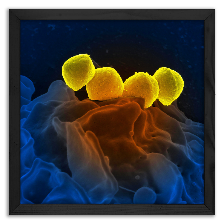 Phagocytosis of Streptococcus bacteria by white blood cells