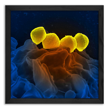 Fagocytoza bakterii Streptococcus przez białe krwinki