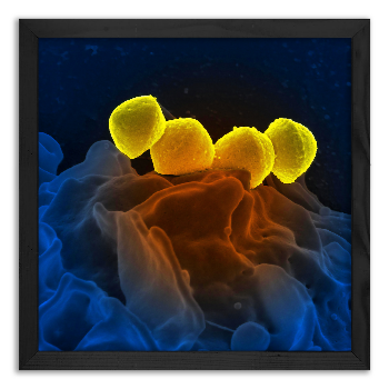 Phagocytosis of Streptococcus bacteria by white blood cells