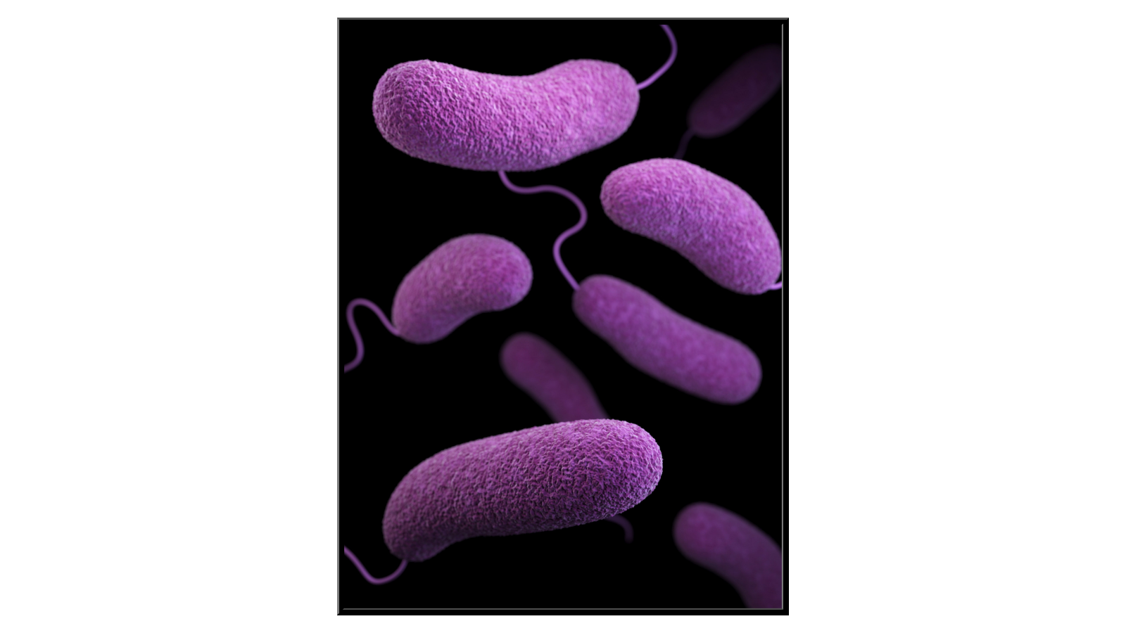 Bakteria Vibrio Parahaemolyticus