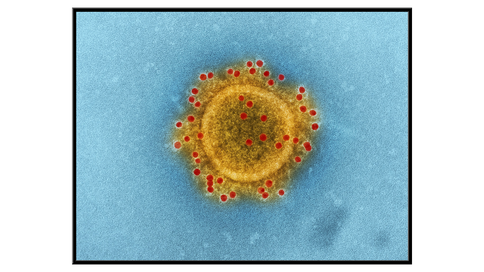 MERS-CoV virus