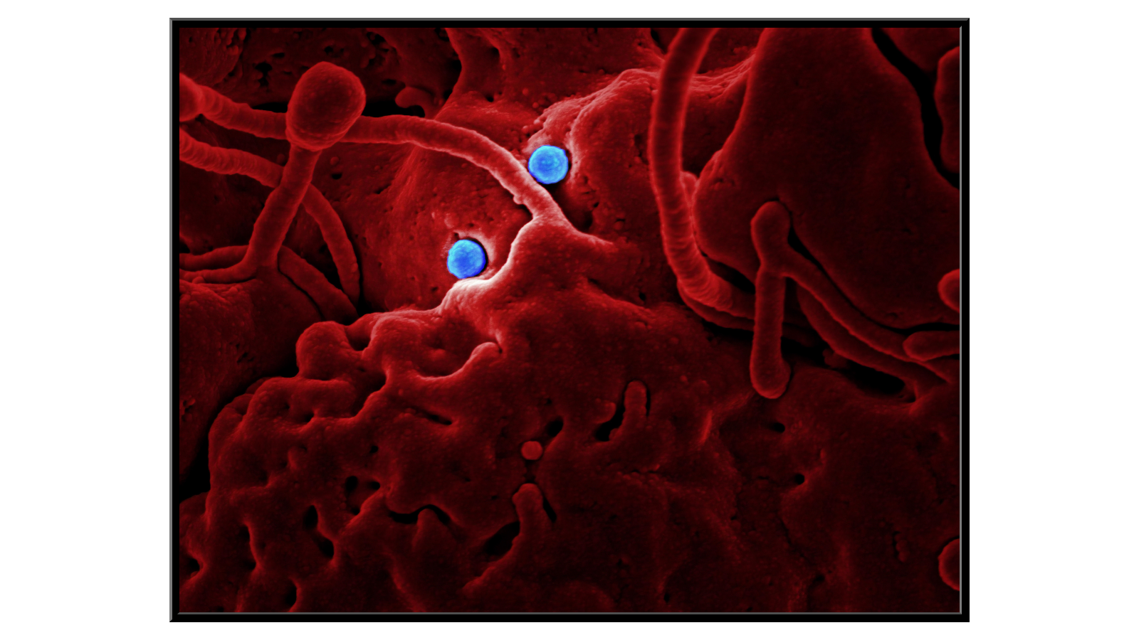 MERS-CoV virus penetrating the epithelium