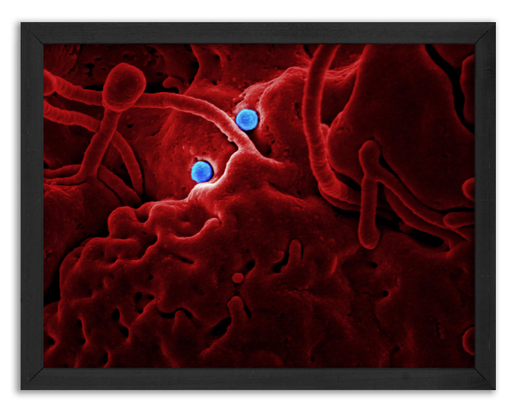 MERS-CoV virus penetrating the epithelium