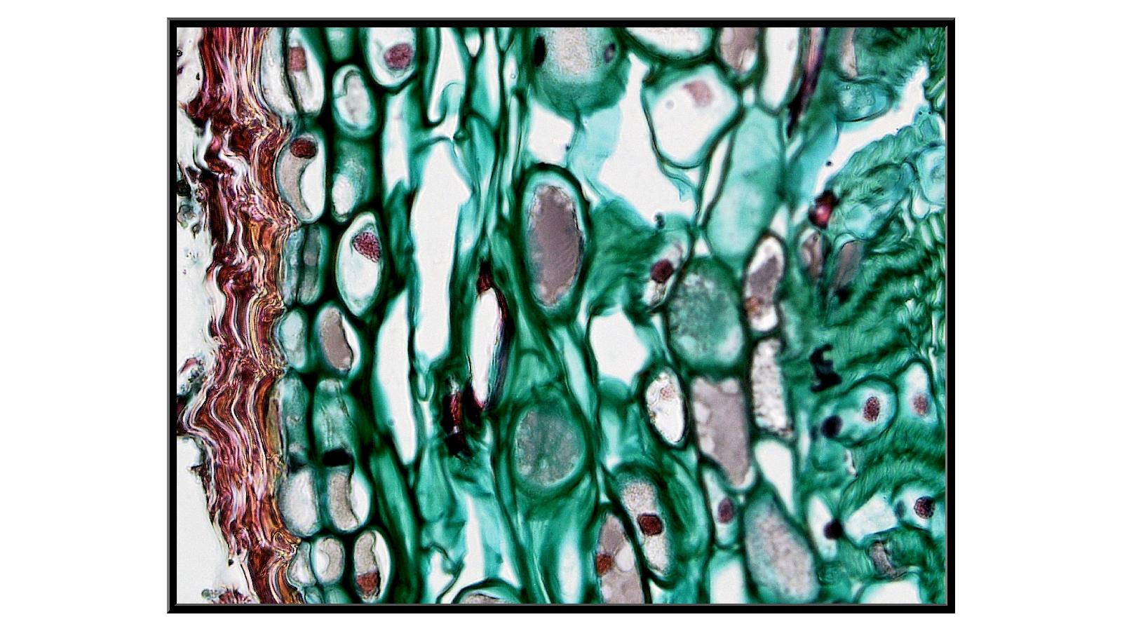 Cross-section of a 2-year-old pine stem - bark x400
