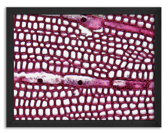 Cross-section of a 3-year-old pine stem x100