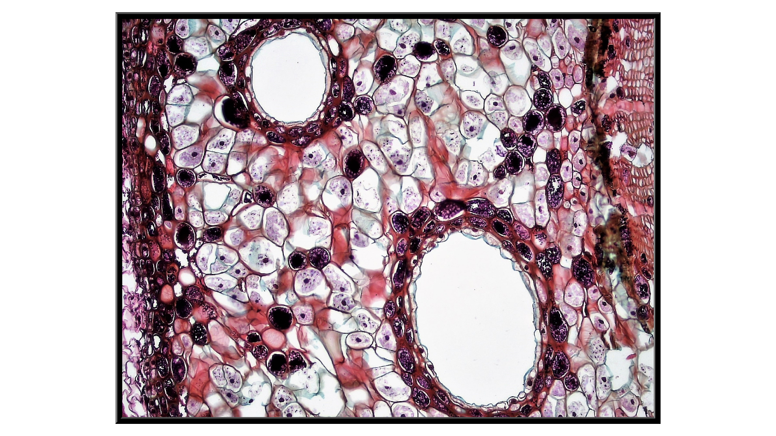 Cross-section of a 3-year-old pine stem - bark x400