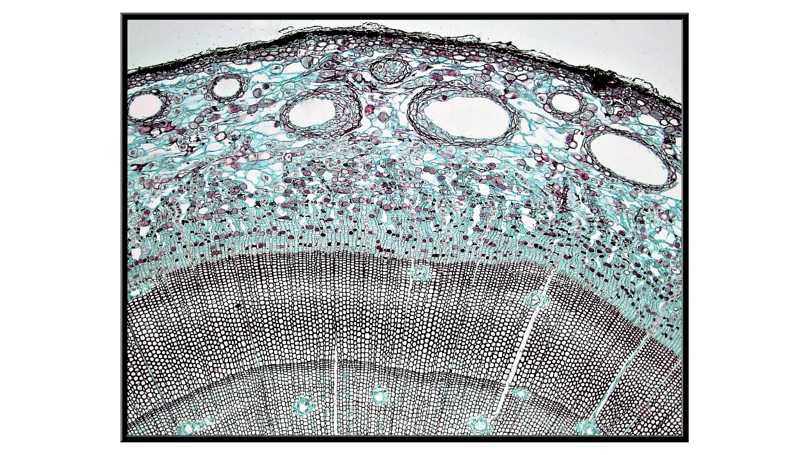 Cross-section of a 4-year-old pine stalk x40