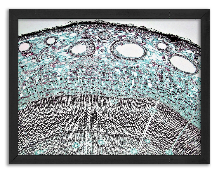 Cross-section of a 4-year-old pine stalk x40