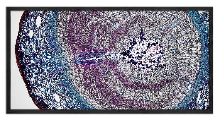 Cross-section of a 5-year-old pine stalk x40