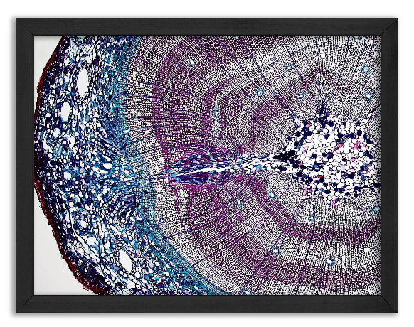 Cross-section of a 5-year-old pine stalk x40