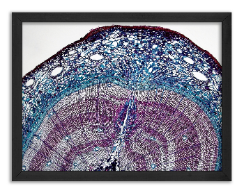 Cross-section of a 5-year-old pine stalk x40 - 3