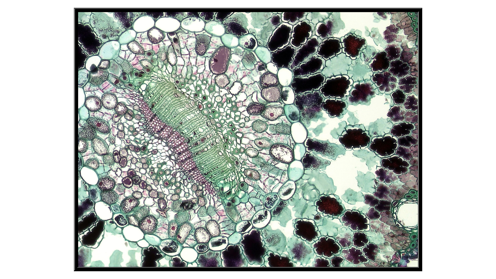 Cross-section through a pine needle - 2