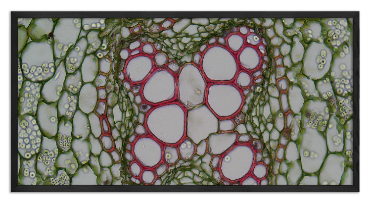 Cross-section of Ranunculus root - 2