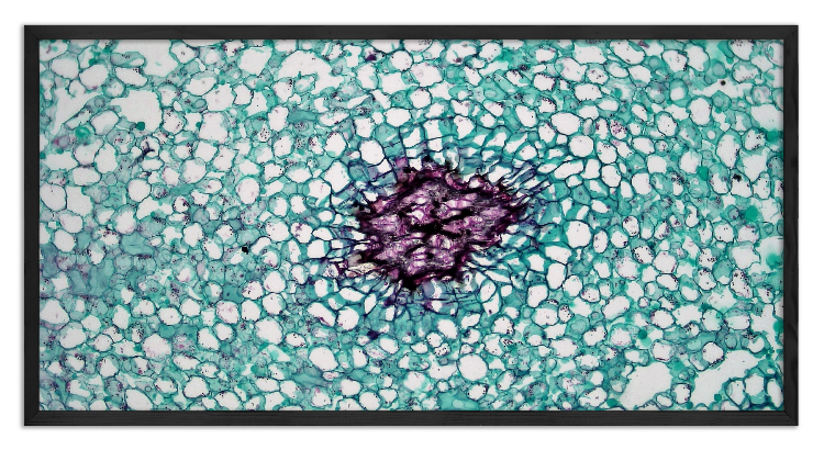 : Cross-section through a Water Lily stem - 3