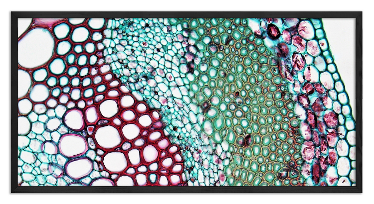 Cross-section of a clover stem - 2