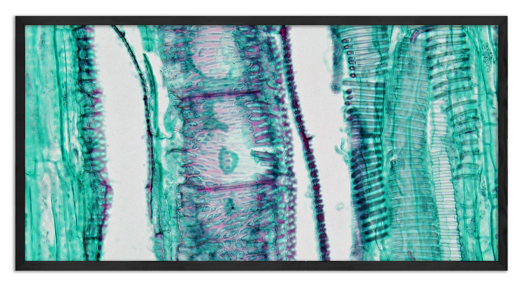 Cross-section of a pumpkin stem - 5