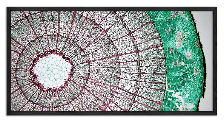 Cross-section through an Elderberry black twig