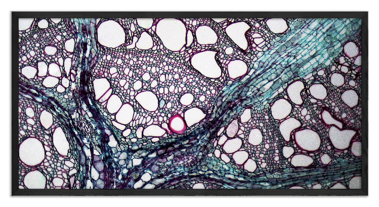 Przekrój łodygi Kokornak wielkolistnego - 3