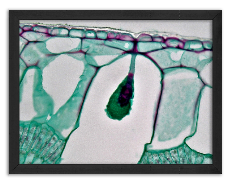 Cross-section through a Ficus leaf - 3