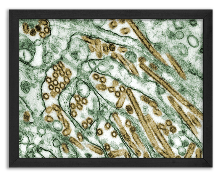 Wirus ptasiej grypy A H5N1 - zdjęcie z 1997 roku